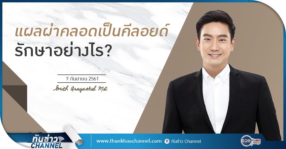 ทันข่าวสุขภาพและความงาม กับ นพ.สมิทธิ์ อารยะสกุล | แผลผ่าคลอดเป็นคีลอยด์ รักษาอย่างไร?