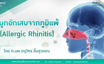 จมูกอักเสบจากภูมิแพ้(Allergic Rhinitis)