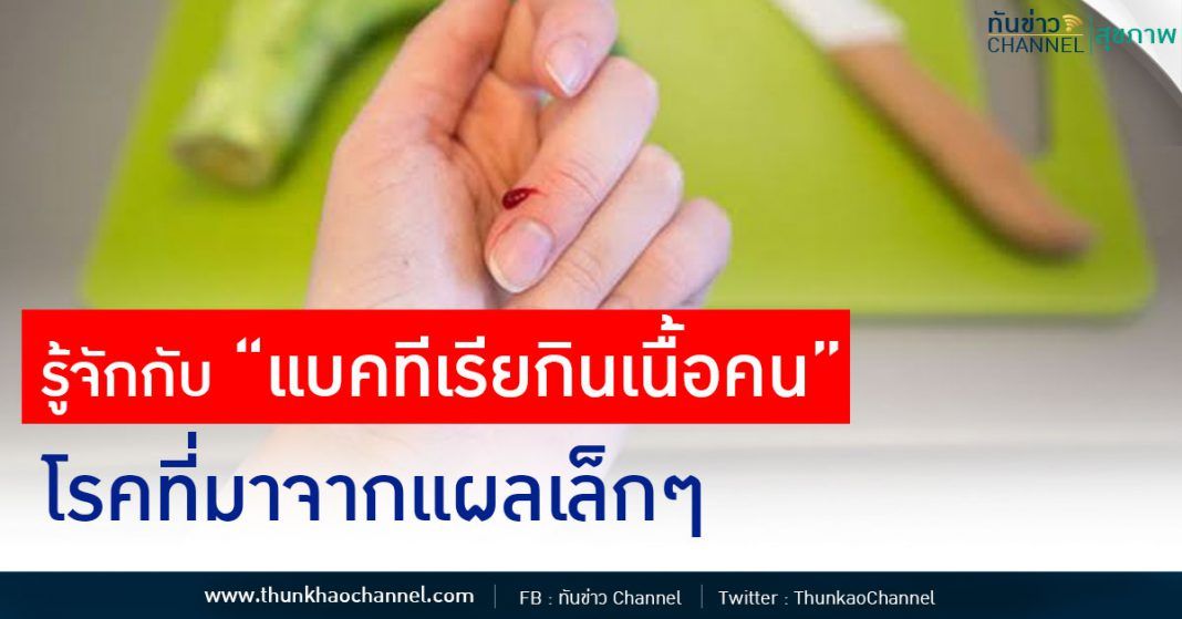 รู้จักกับ “แบคทีเรียกินเนื้อคน” โรคที่มาจากแผลเล็กๆ