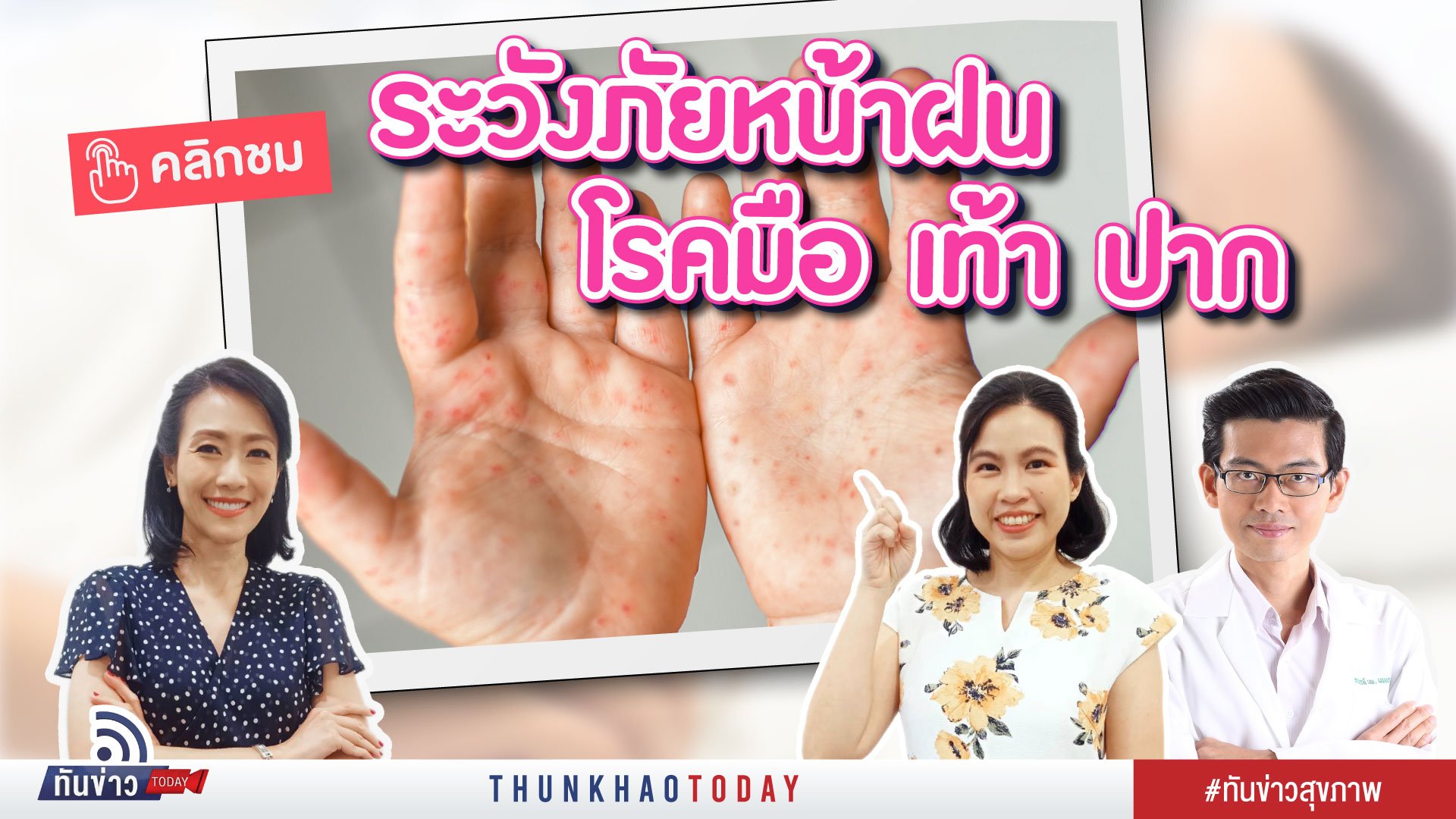 ระวังภัยหน้าฝน โรคมือ เท้า ปาก